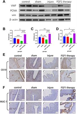 Fibroblast growth factor 1 ameliorates thin endometrium in rats through activation of the autophagic pathway